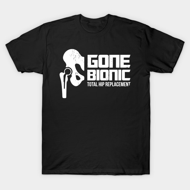 Gone Bionic, Total Hip Replacement T-Shirt by tanambos